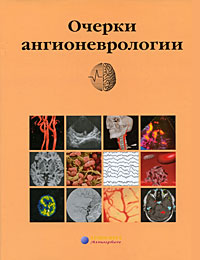 Очерки ангионеврологии Издательство: Атмосфера, 2005 г Суперобложка, 368 стр ISBN 5-902123-19-4 Тираж: 1000 экз Формат: 60x90/8 (~220х290 мм) Мелованная бумага инфо 13146c.