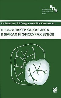 Профилактика кариеса в ямках и фиссурах зубов Серия: Библиотека практического врача инфо 13223c.